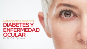 Diabetes y enfermedad ocular: retinopatía diabética