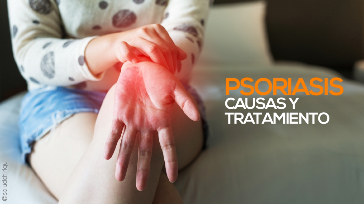 Psoriasis: causas y tratamiento