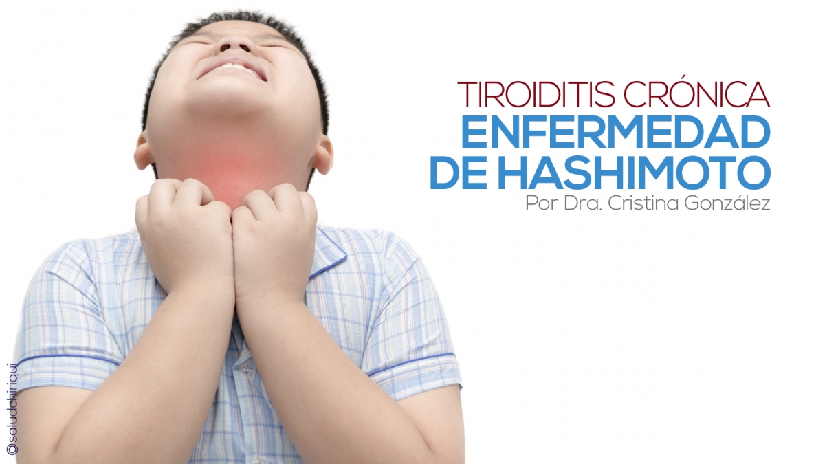 Enfermedad de Hashimoto: Tiroiditis crónica