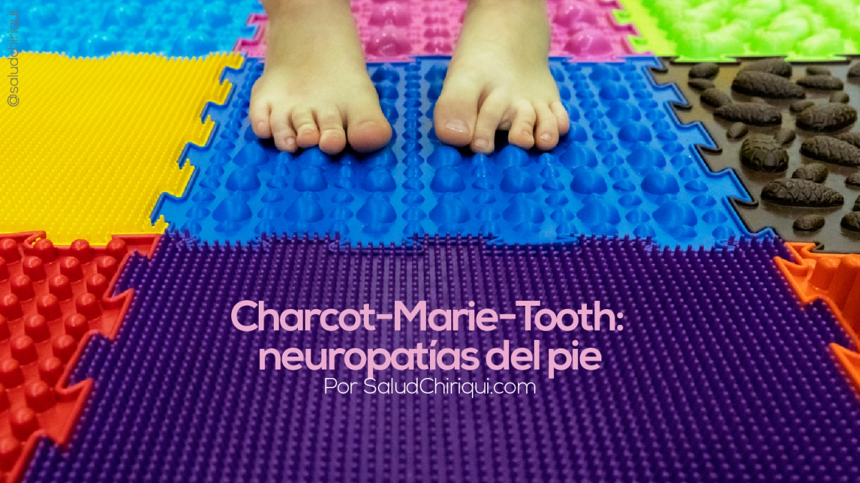 Charcot-Marie-Tooth: neuropatías del pie