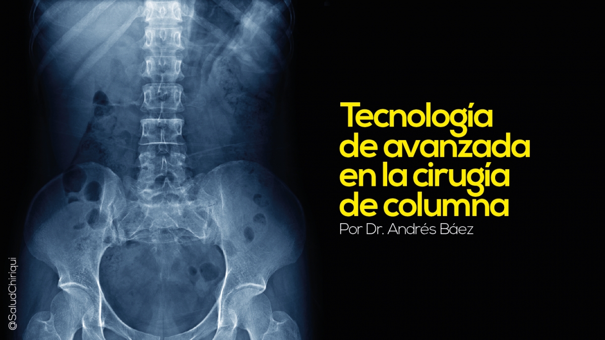 Tecnología de avanzada en la cirugía de columna