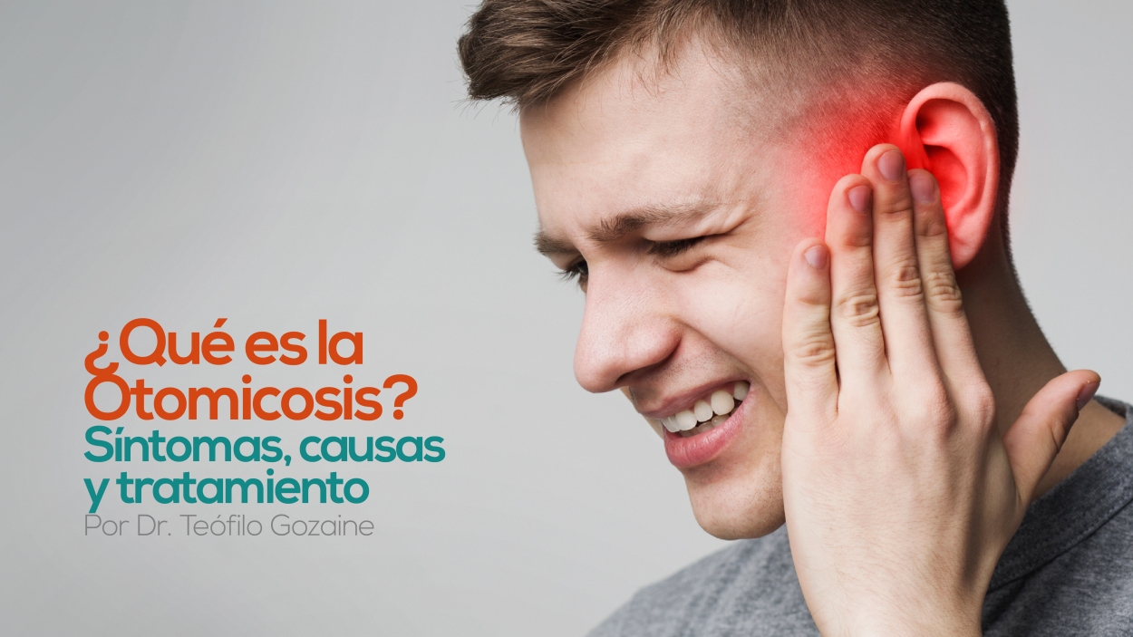 ¿Qué es la otomicosis? Síntomas, causas y cómo tratar la enfermedad