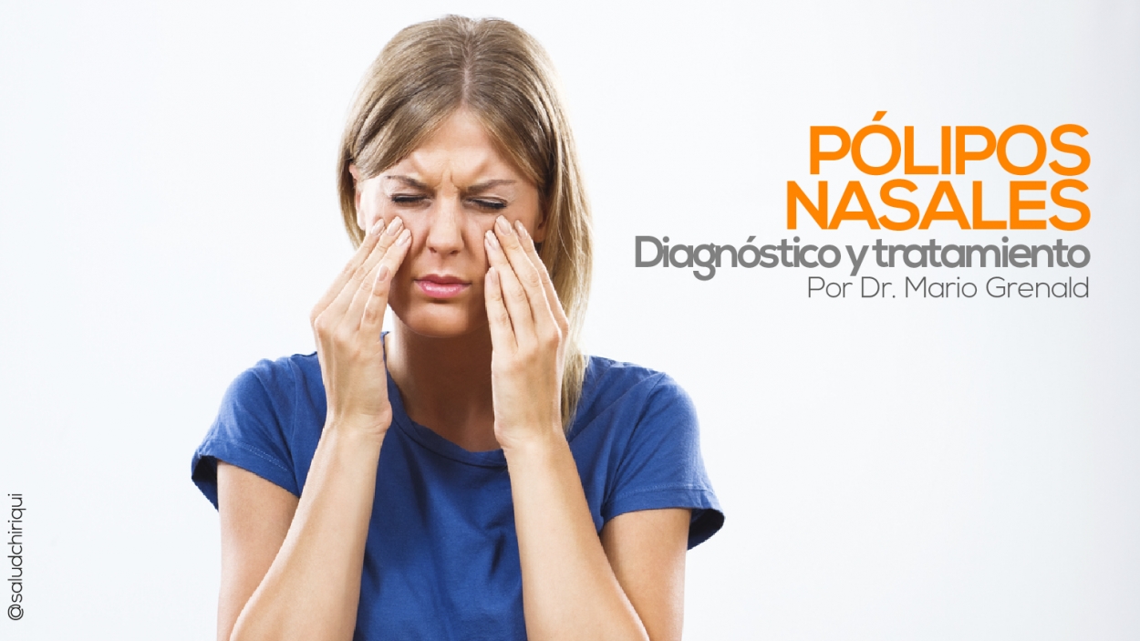 Pólipos nasales: Diagnóstico y tratamiento